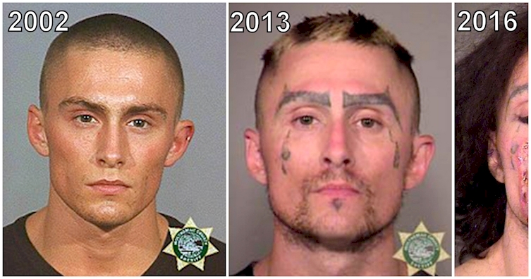 What 14 Years Of Doing Meth Does To A Person